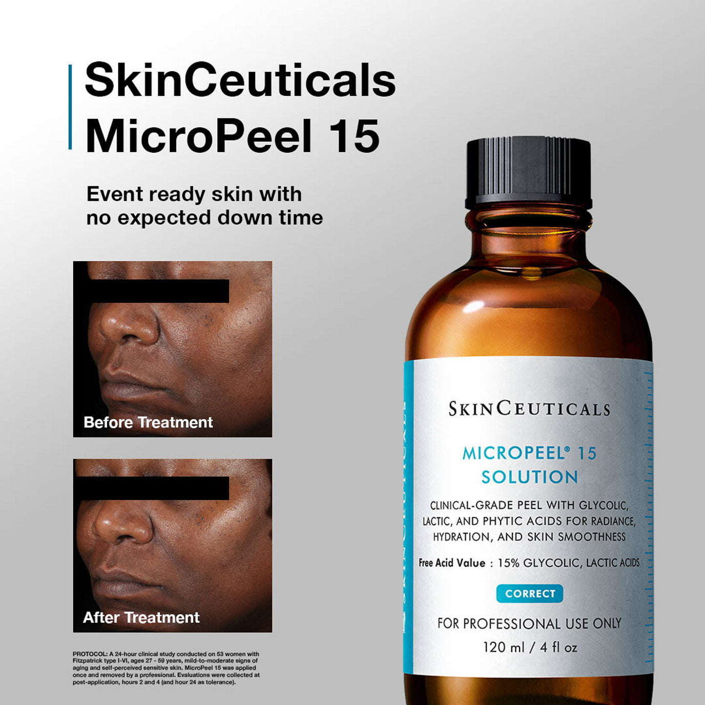 Red Carpet Peel