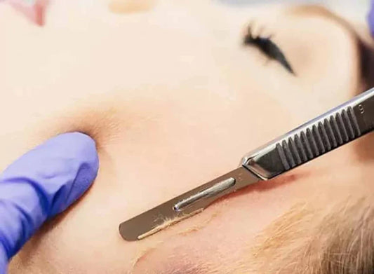 Dermaplaning add on